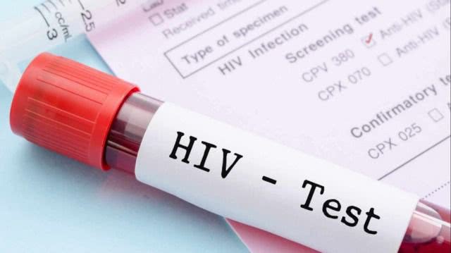 В центре Херсона будут бесплатно тестировать на ВИЧ
