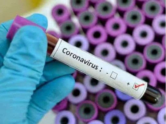 В Минздраве назвали причину смерти большинства пациентов с коронавирусом
