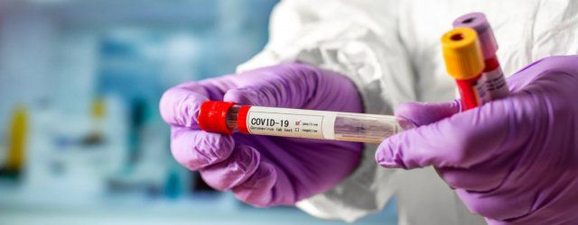 На Херсонщине за сутки выявили 34 новых инфицированных COVID-19