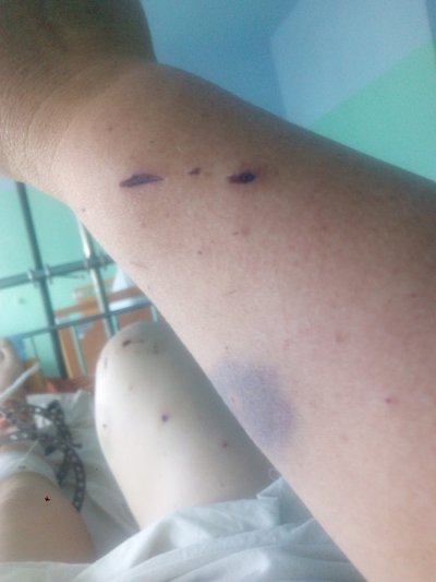 Жителька Високопілля після обстрілів: «Лихо постукало в стіни мого будинку»