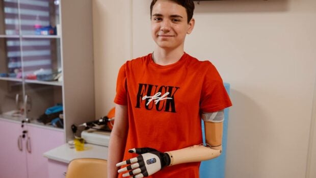 Втратив руку під час обстрілу: в Охматдиті проходить реабілітацію 14-річний хлопець із біонічним протезом